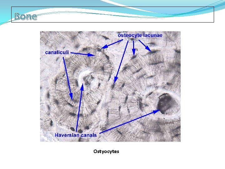 Bone Ostyocytes 