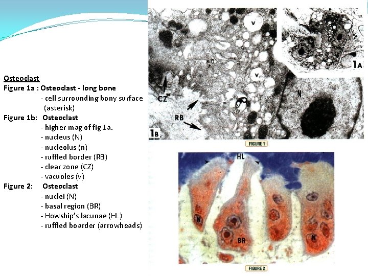 Osteoclast Figure 1 a : Osteoclast - long bone - cell surrounding bony surface