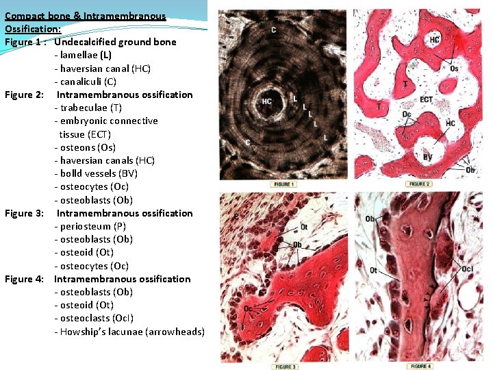 Compact bone & Intramembranous Ossification: Figure 1 : Undecalcified ground bone - lamellae (L)