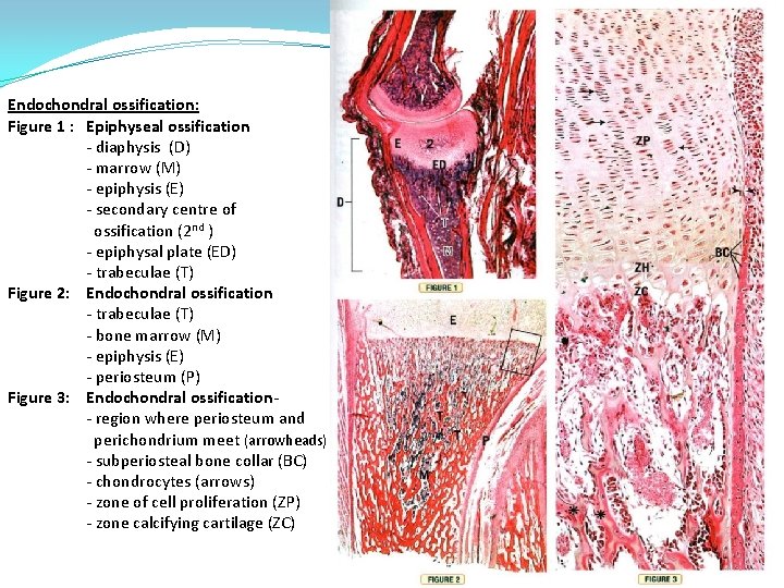 Endochondral ossification: Figure 1 : Epiphyseal ossification - diaphysis (D) - marrow (M) -