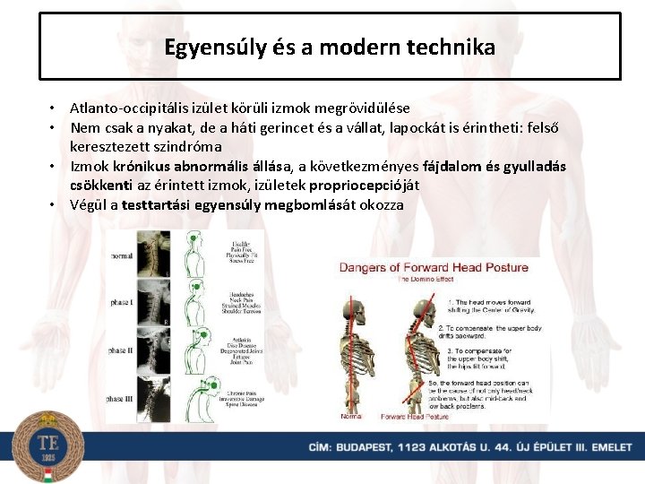 Egyensúly és a modern technika • Atlanto-occipitális izület körüli izmok megrövidülése • Nem csak