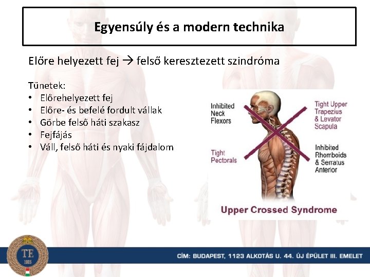 Egyensúly és a modern technika Előre helyezett fej felső keresztezett szindróma Tünetek: • Előrehelyezett