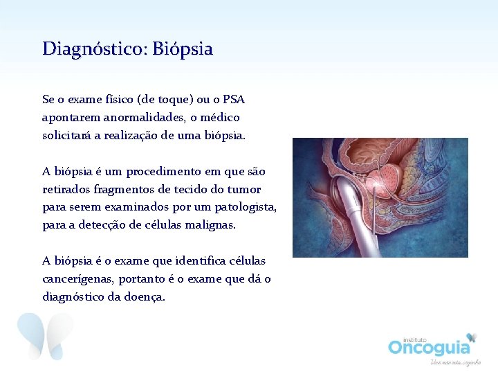 Diagnóstico: Biópsia Se o exame físico (de toque) ou o PSA apontarem anormalidades, o