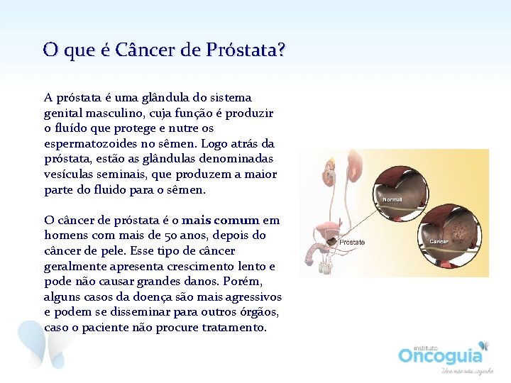 O que é Câncer de Próstata? A próstata é uma glândula do sistema genital