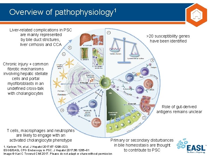 Overview of pathophysiology 1 Liver-related complications in PSC are mainly represented by bile duct