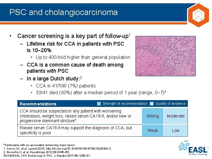 PSC and cholangiocarcinoma • Cancer screening is a key part of follow-up 1 –