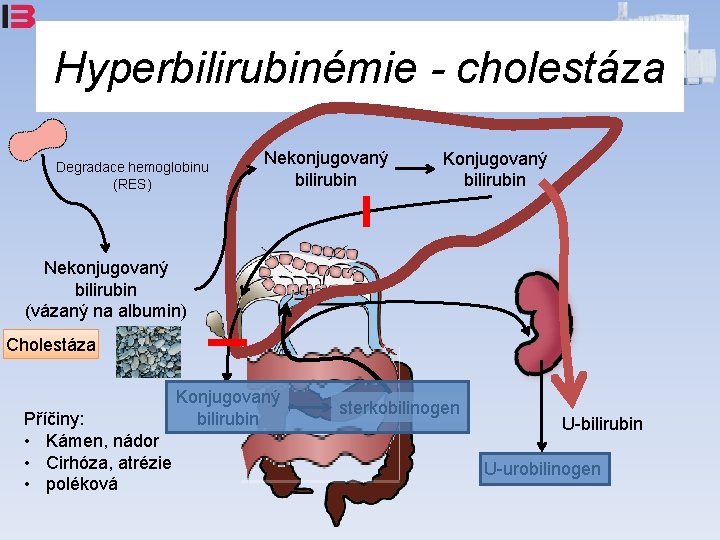Hyperbilirubinémie - cholestáza Degradace hemoglobinu (RES) Nekonjugovaný bilirubin Konjugovaný bilirubin Nekonjugovaný bilirubin (vázaný na
