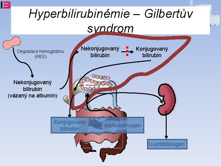 Hyperbilirubinémie – Gilbertův syndrom Degradace hemoglobinu (RES) Nekonjugovaný bilirubin Konjugovaný bilirubin Nekonjugovaný bilirubin (vázaný