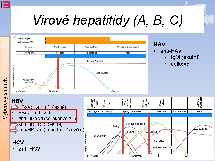 Virové hepatitidy (A, B, C) Výběrový snímek HAV • anti-HAV • Ig. M (akutní)