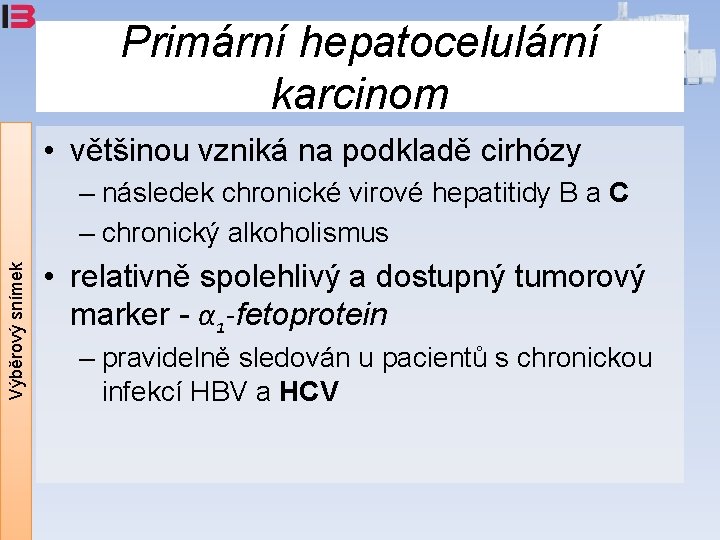 Primární hepatocelulární karcinom • většinou vzniká na podkladě cirhózy Výběrový snímek – následek chronické