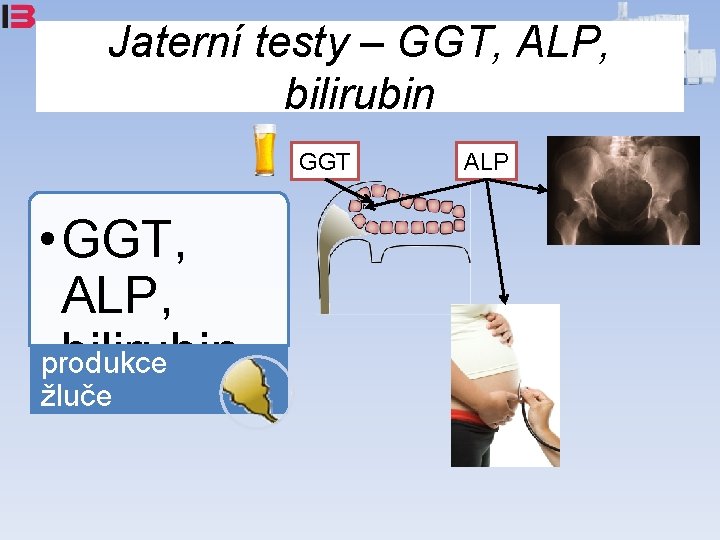 Jaterní testy – GGT, ALP, bilirubin GGT • GGT, ALP, bilirubin produkce žluče ALP