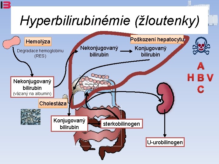 Hyperbilirubinémie (žloutenky) Poškození hepatocytu Hemolýza Degradace hemoglobinu (RES) Nekonjugovaný bilirubin Konjugovaný bilirubin A HBV