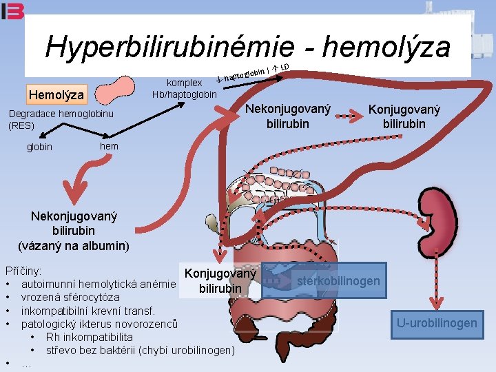 Hyperbilirubinémie - hemolýza D n|↑L oglobi ↓ hapt komplex Hb/haptoglobin Hemolýza Degradace hemoglobinu (RES)