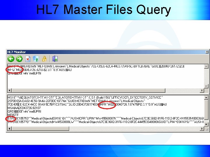 HL 7 Master Files Query 