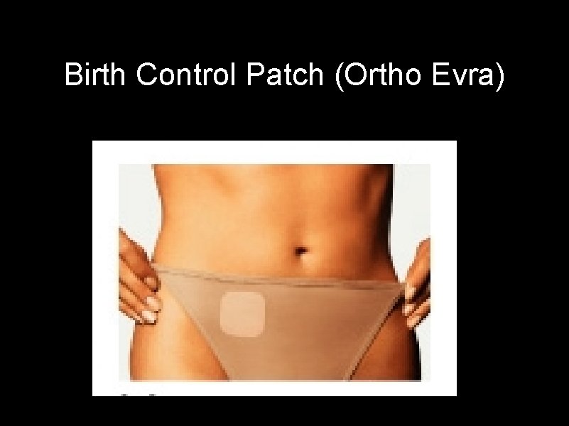 Birth Control Patch (Ortho Evra) 