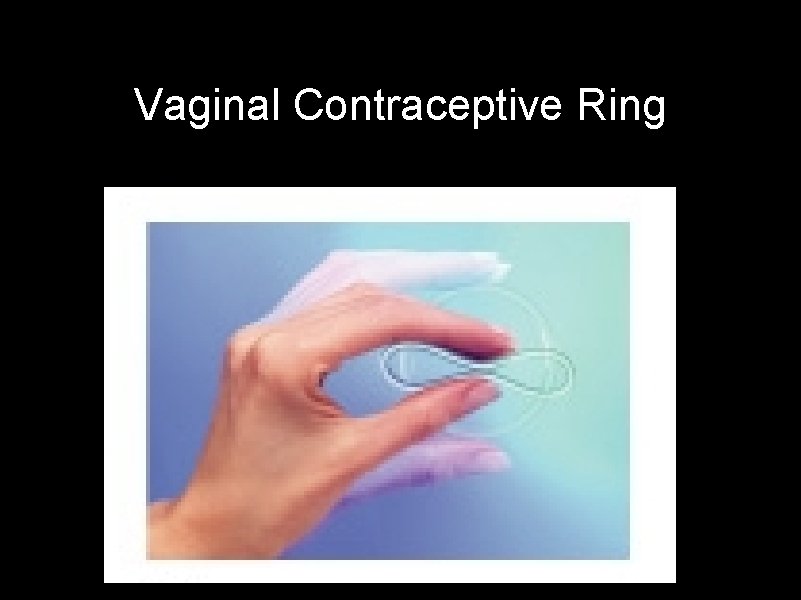 Vaginal Contraceptive Ring 