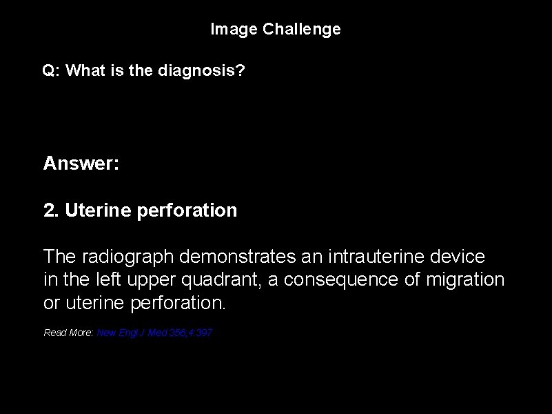 Image Challenge Q: What is the diagnosis? Answer: 2. Uterine perforation The radiograph demonstrates
