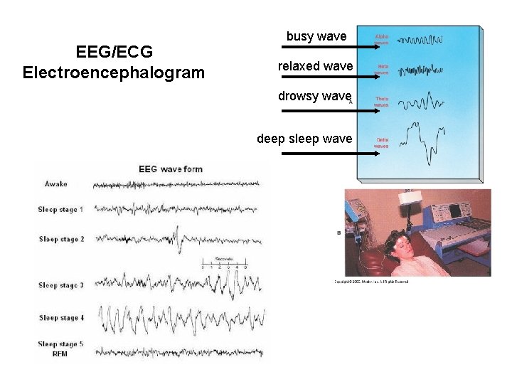 EEG/ECG Electroencephalogram busy wave relaxed wave drowsy wave deep sleep wave EEG/ECG Electroencephalogram busy wave relaxed wave drowsy wave deep sleep wave