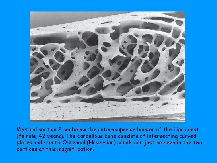 Vertical section 2 cm below the anterosuperior border of the iliac crest (female, 42