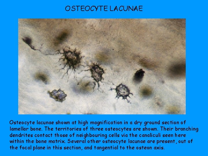 OSTEOCYTE LACUNAE Osteocyte lacunae shown at high magnification in a dry ground section of