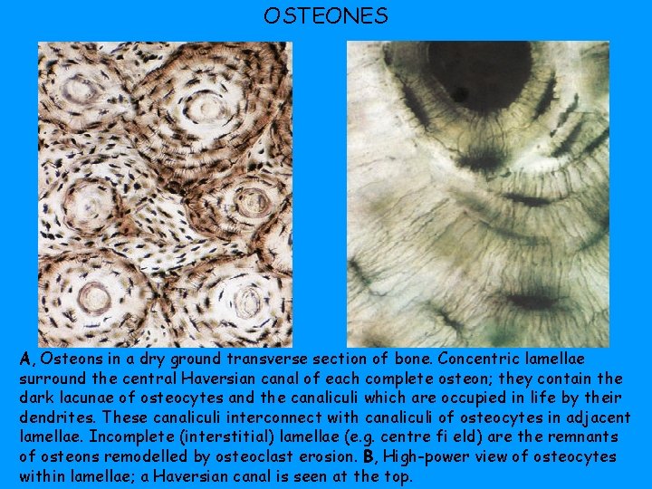 OSTEONES A, Osteons in a dry ground transverse section of bone. Concentric lamellae surround