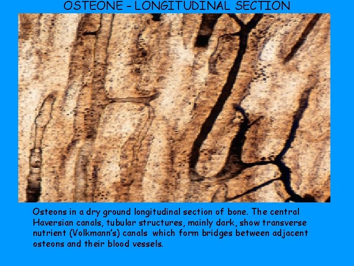 OSTEONE – LONGITUDINAL SECTION Osteons in a dry ground longitudinal section of bone. The