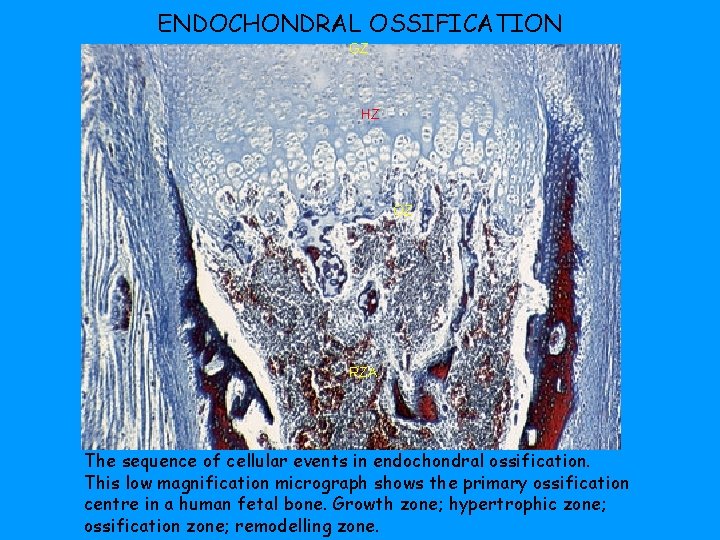 ENDOCHONDRAL OSSIFICATION GZ HZ OZ RZA The sequence of cellular events in endochondral ossification.