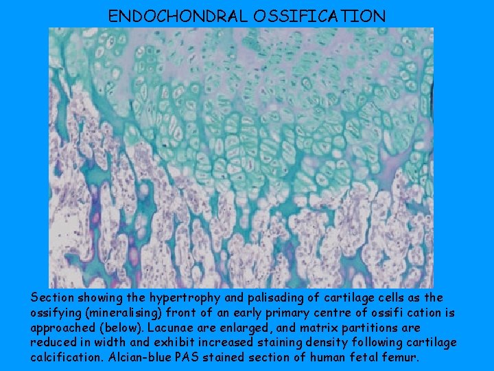 ENDOCHONDRAL OSSIFICATION Section showing the hypertrophy and palisading of cartilage cells as the ossifying