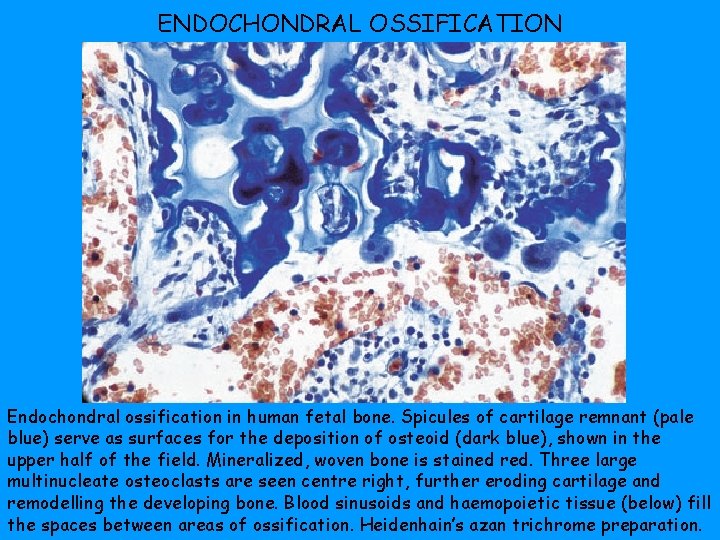 ENDOCHONDRAL OSSIFICATION Endochondral ossification in human fetal bone. Spicules of cartilage remnant (pale blue)