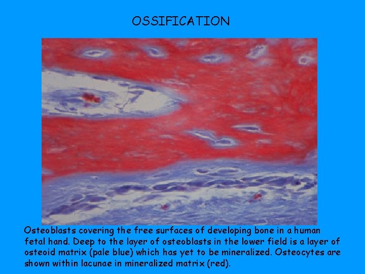 OSSIFICATION Osteoblasts covering the free surfaces of developing bone in a human fetal hand.