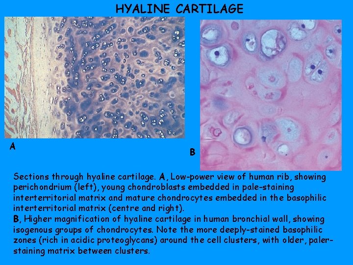 HYALINE CARTILAGE A B Sections through hyaline cartilage. A, Low-power view of human rib,