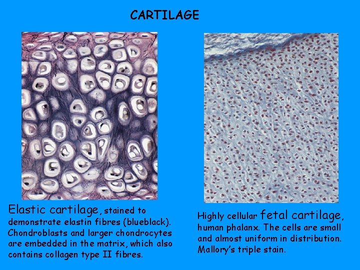 CARTILAGE Elastic cartilage, stained to demonstrate elastin fibres (blueblack). Chondroblasts and larger chondrocytes are