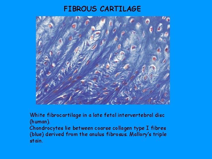 FIBROUS CARTILAGE White fibrocartilage in a late fetal intervertebral disc (human). Chondrocytes lie between