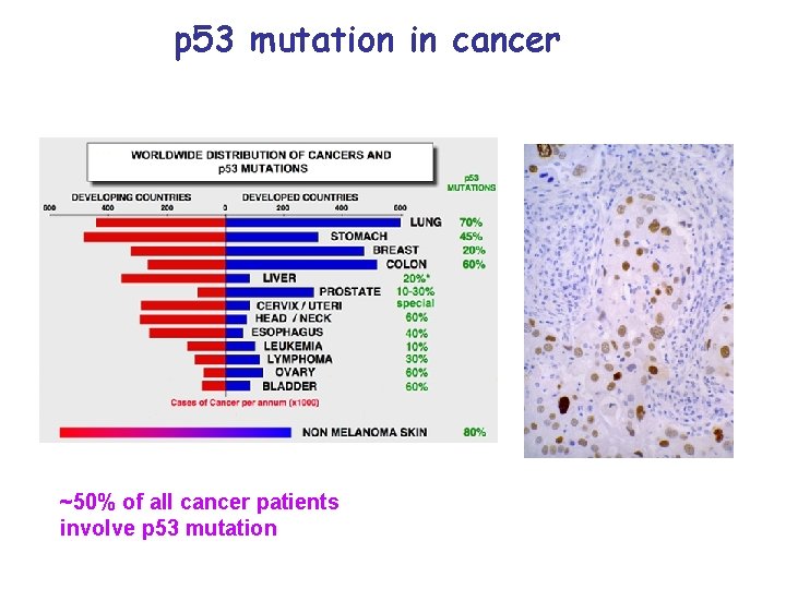 p 53 mutation in cancer ~50% of all cancer patients involve p 53 mutation