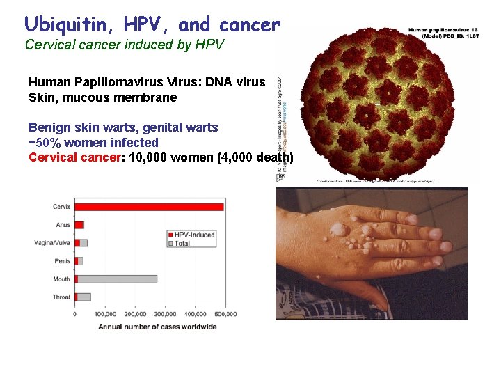 Ubiquitin, HPV, and cancer Cervical cancer induced by HPV Human Papillomavirus Virus: DNA virus