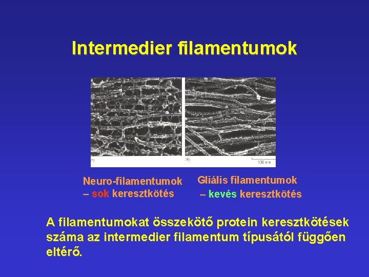 Intermedier filamentumok Neuro-filamentumok – sok keresztkötés Gliális filamentumok – kevés keresztkötés A filamentumokat összekötő