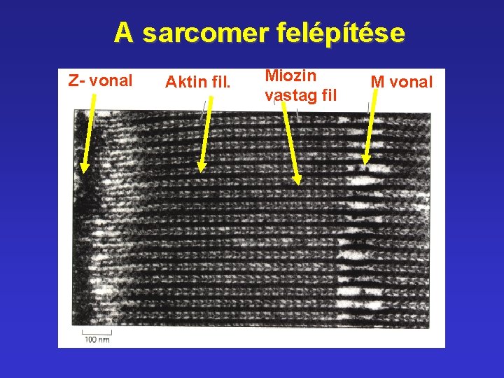 A sarcomer felépítése Z- vonal Aktin fil. Miozin vastag fil M vonal 
