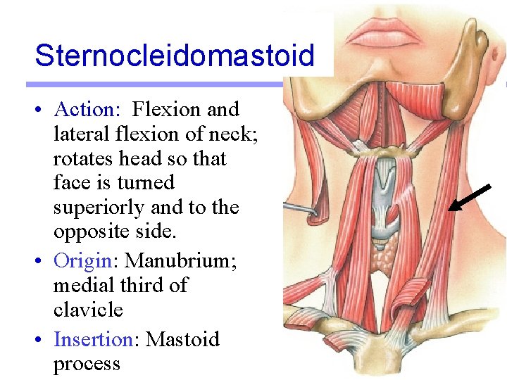 Sternocleidomastoid • Action: Flexion and lateral flexion of neck; rotates head so that face