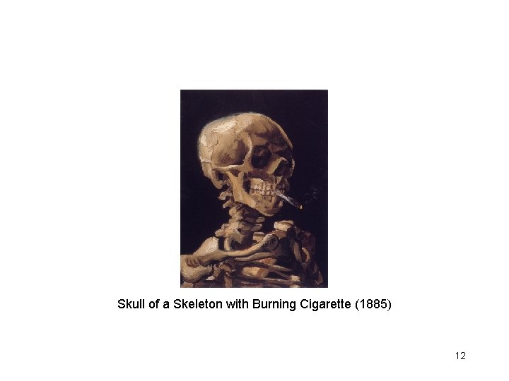 Skull of a Skeleton with Burning Cigarette (1885) 12 