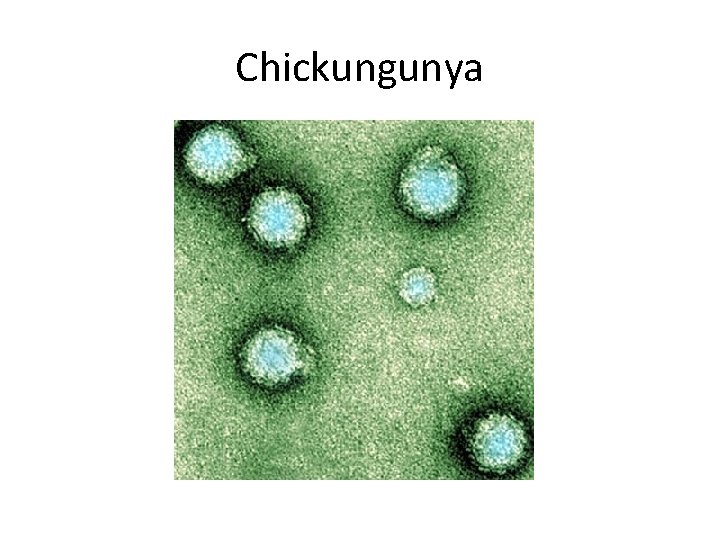 Chickungunya 