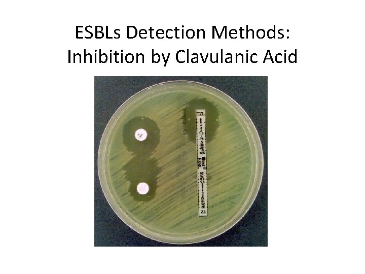 ESBLs Detection Methods: Inhibition by Clavulanic Acid 