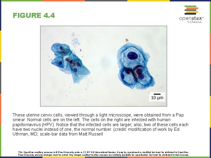 FIGURE 4. 4 These uterine cervix cells, viewed through a light microscope, were obtained FIGURE 4. 4 These uterine cervix cells, viewed through a light microscope, were obtained