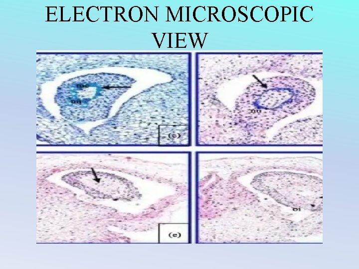 ELECTRON MICROSCOPIC VIEW 