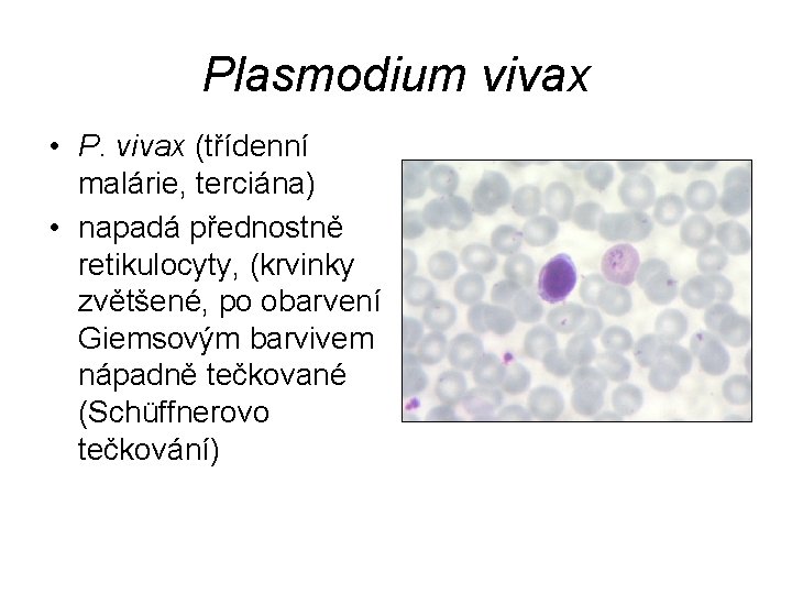 Plasmodium vivax • P. vivax (třídenní malárie, terciána) • napadá přednostně retikulocyty, (krvinky zvětšené,
