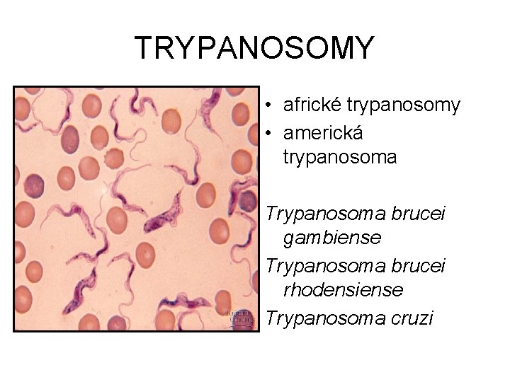 TRYPANOSOMY • africké trypanosomy • americká trypanosoma Trypanosoma brucei gambiense Trypanosoma brucei rhodensiense Trypanosoma
