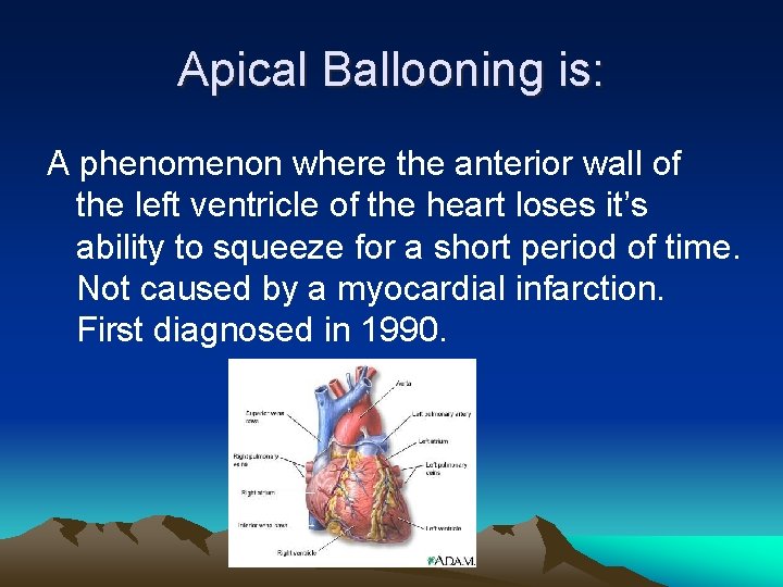 Apical Ballooning is: A phenomenon where the anterior wall of the left ventricle of