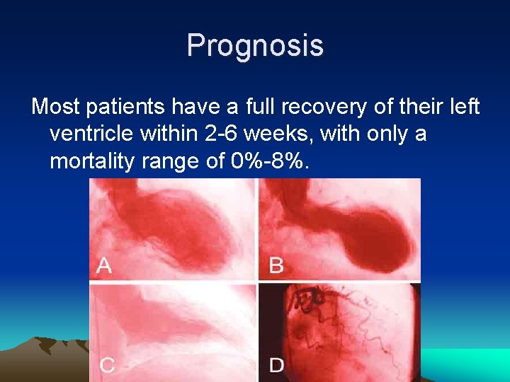 Prognosis Most patients have a full recovery of their left ventricle within 2 -6