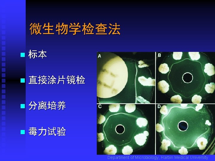 微生物学检查法 n 标本 n 直接涂片镜检 n 分离培养 n 毒力试验 Department of Microbiology, Harbin Medical