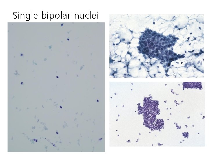 Single bipolar nuclei 