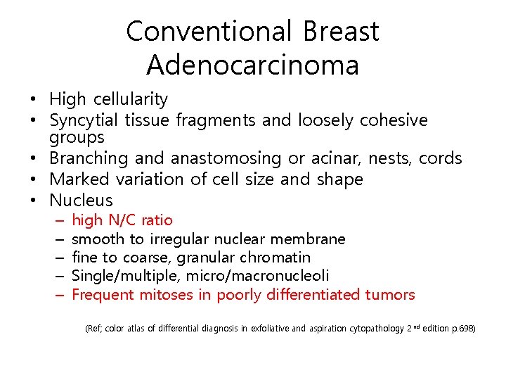 Conventional Breast Adenocarcinoma • High cellularity • Syncytial tissue fragments and loosely cohesive groups